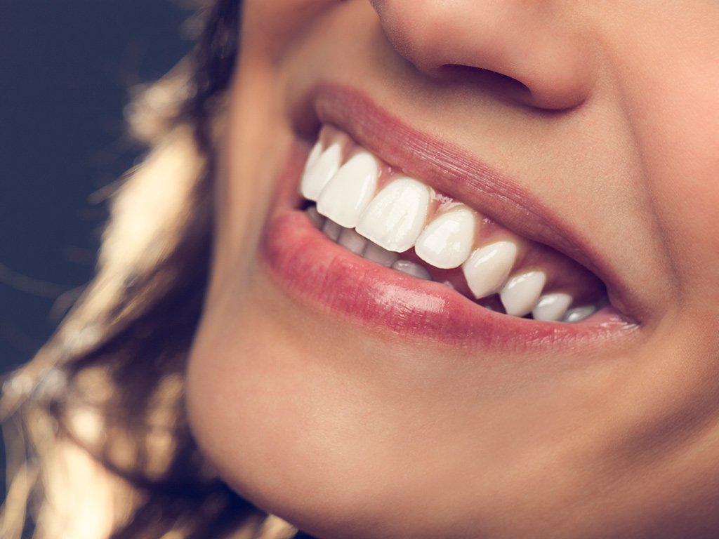 Professional teeth whitening treatment from a trusted dentist in Elgin, TX.