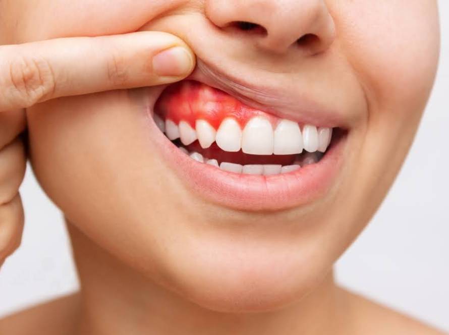 Periodontal treatment and maintenance from a trusted dentist or periodontist in Elgin, TX.