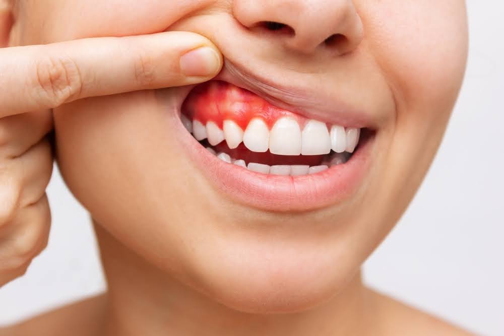 Periodontics in Elgin, TX