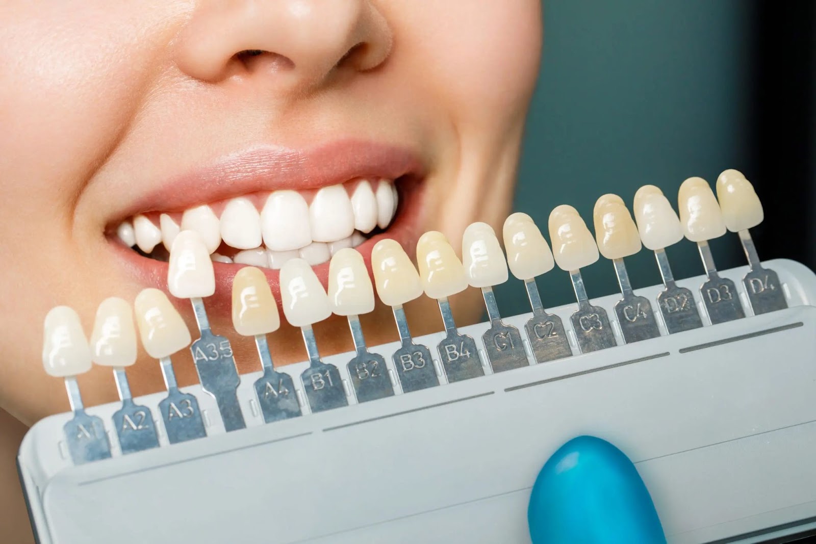 Porcelain Veneers in Elgin, TX