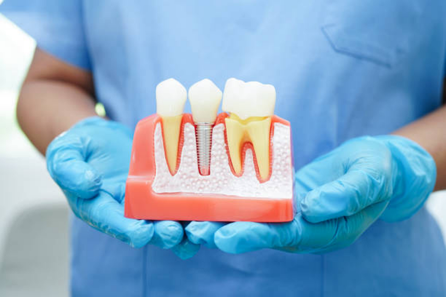Dental Implants in Elgin, TX