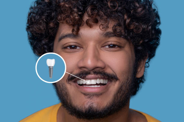 Restore your smile with dental implants in Elgin, TX.