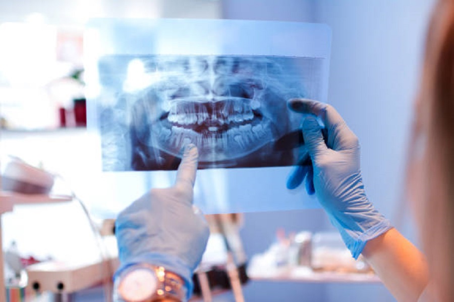 Affordable Dental X-rays in Elgin, TX