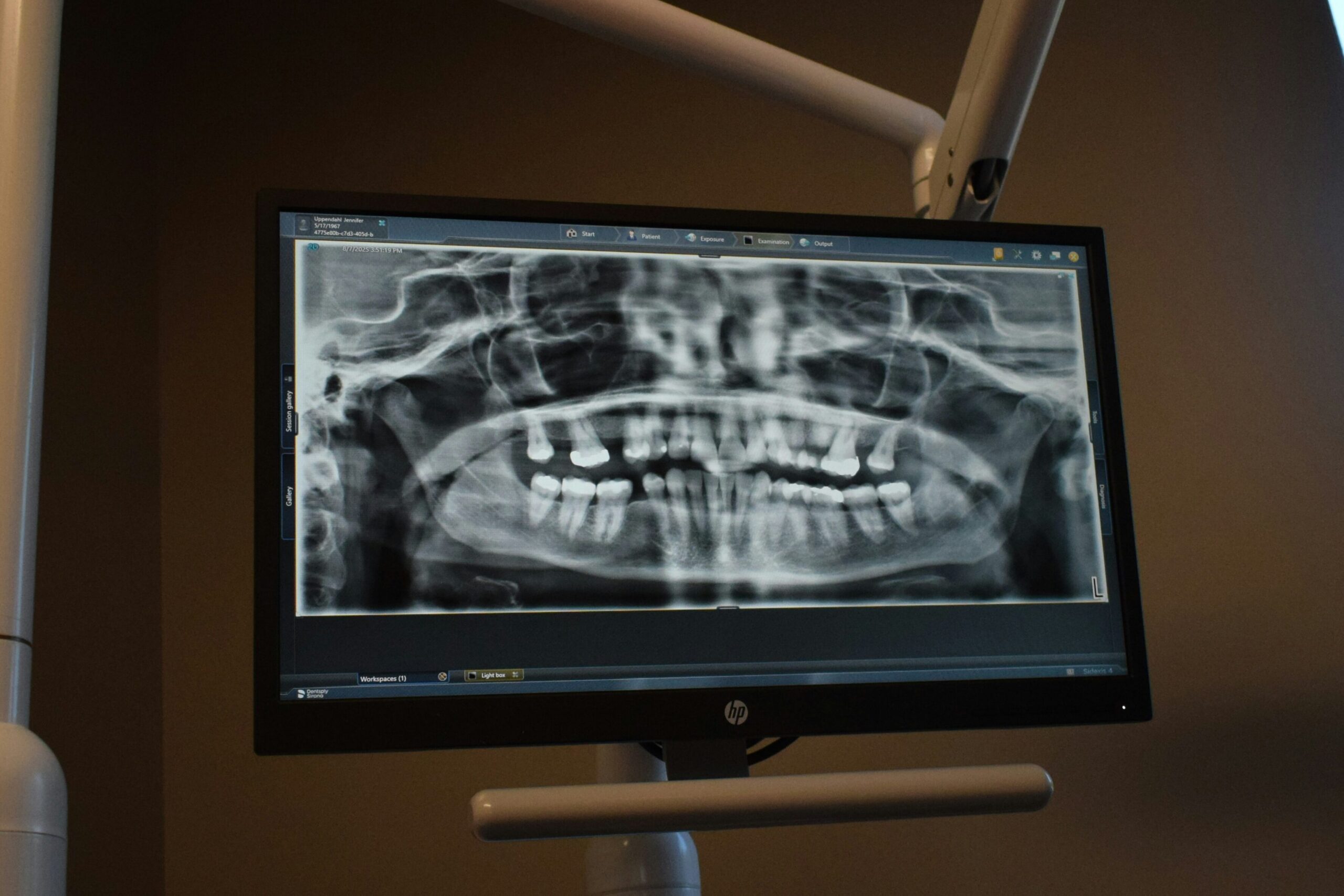 Digital X-Rays